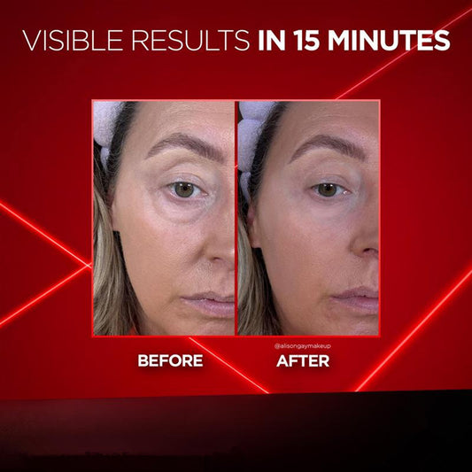 BARUBT Eye Cream Lifts Dark Circles, Hydrates And Moisturizes Eye Cream