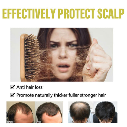 OUHOE Ginger Dense Hair Shampoo For Relieving Itching