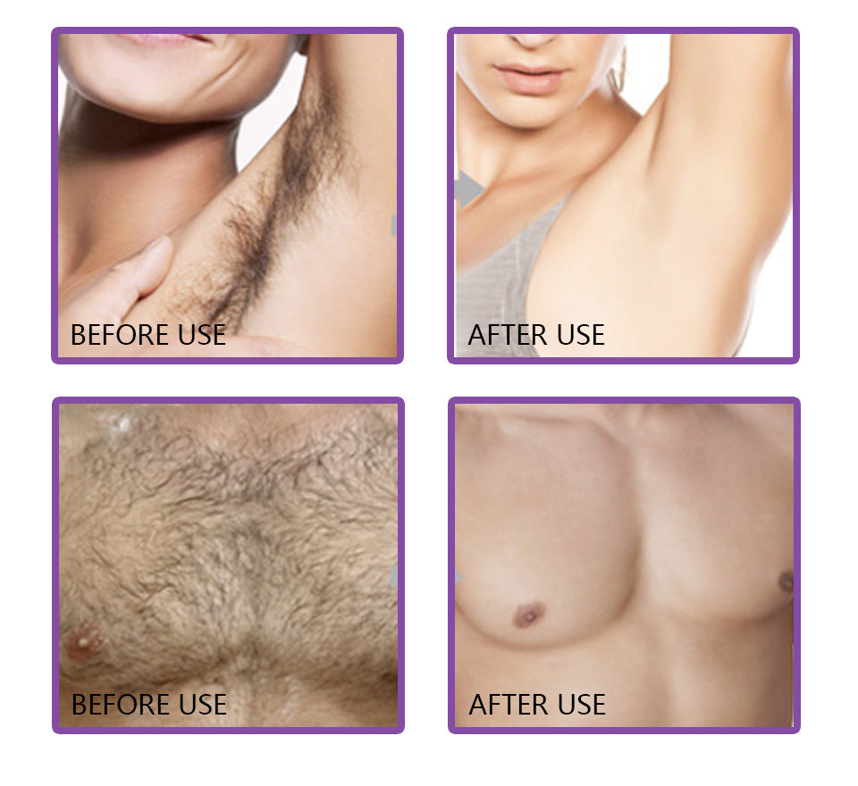 كريم لطيف وغير مهيج لإزالة الشعر