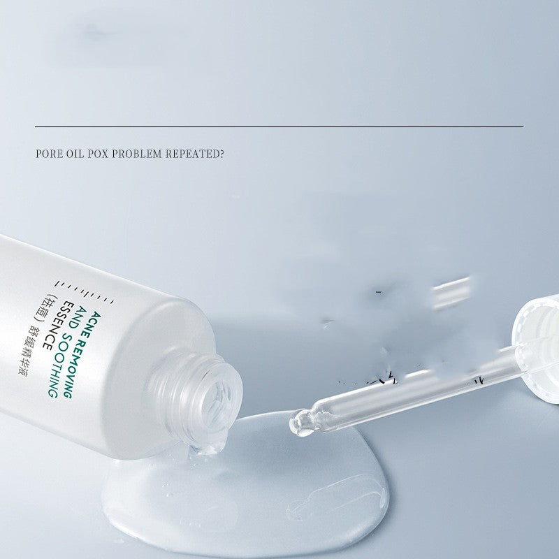 Soothing Care Solution Shrink Pores Smallpox Diluting