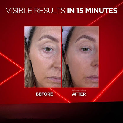 BARUBT Eye Cream Lifts Dark Circles, Hydrates And Moisturizes Eye Cream