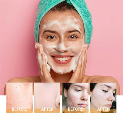 Turmeric Care Solution Moisturizing And Nourishing