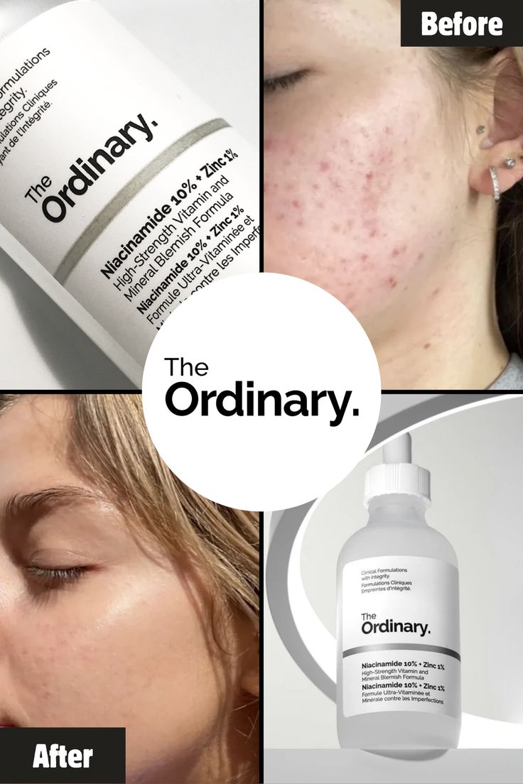 The Ordinary Hyaluronic Acid 2% + B5 Serum